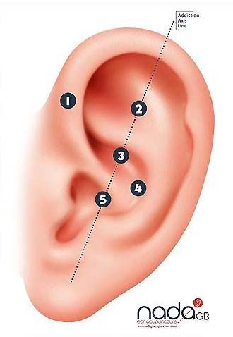 Image of ear